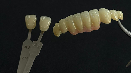 zirconia-vinayaga dental lab